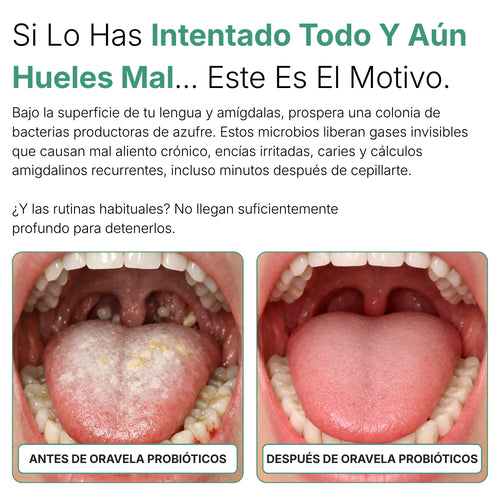Probiotico orale Oravita